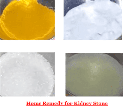 Best Way To Get Rid Of Kidney Stone